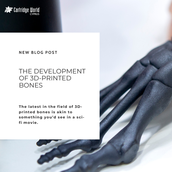WHAT’S THE SCIENCE BEHIND 3D-PRINTED BONES?